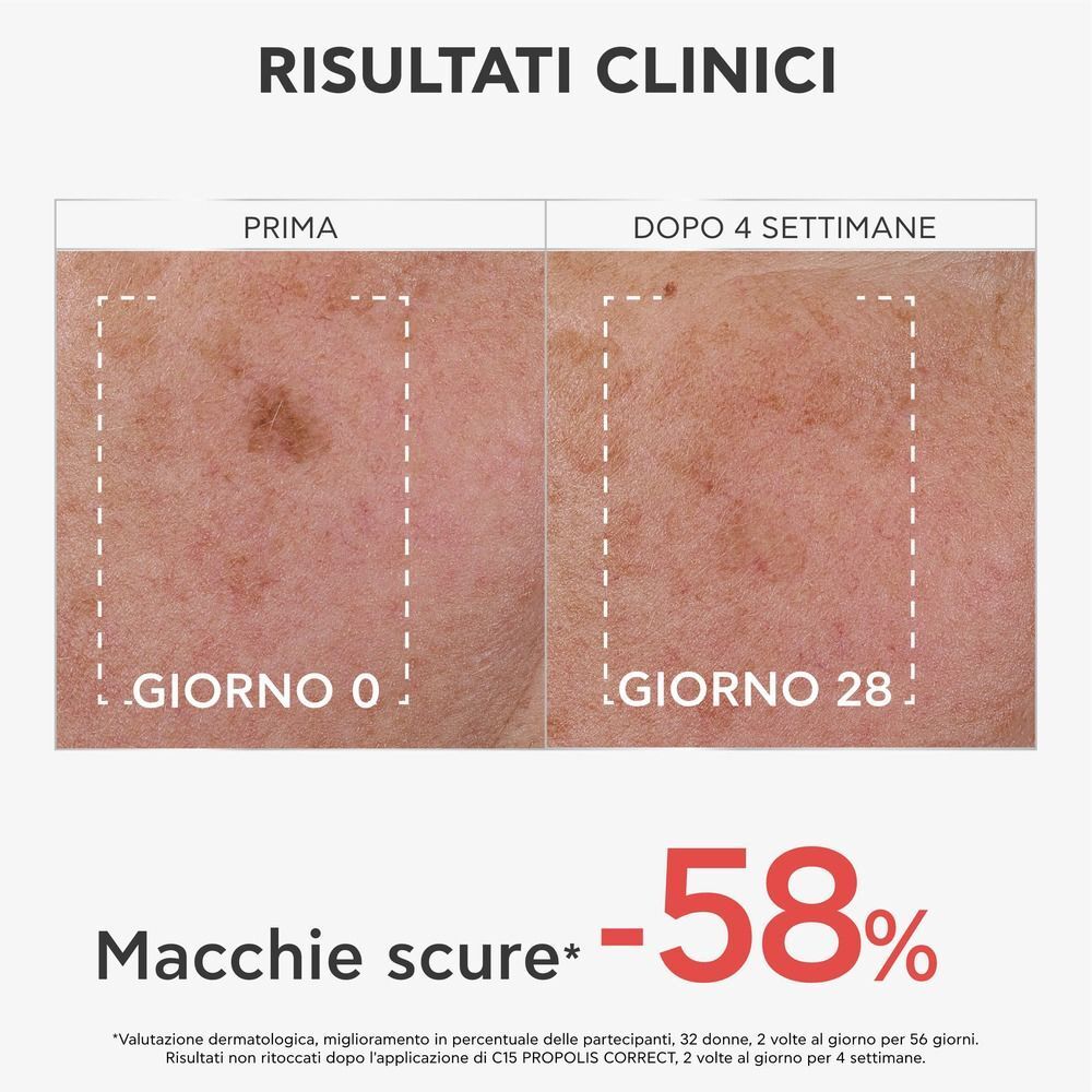 Risultati clinici: pelle prima e dopo 4 settimane di uso del siero APIVITA C15 Propolis Correct.