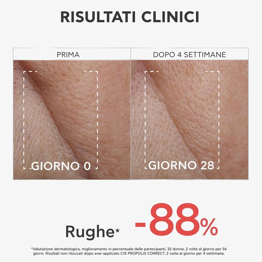 Risultati clinici: Confronto prima-dopo pelle con rughe dopo 4 settimane di siero APIVITA C15 Propolis Correct.