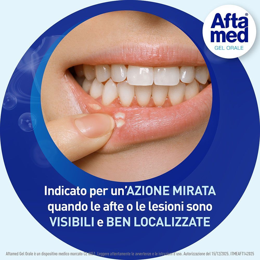 Afta Med Gel Orale: Indicato per afte e lesioni visibili e localizzate.