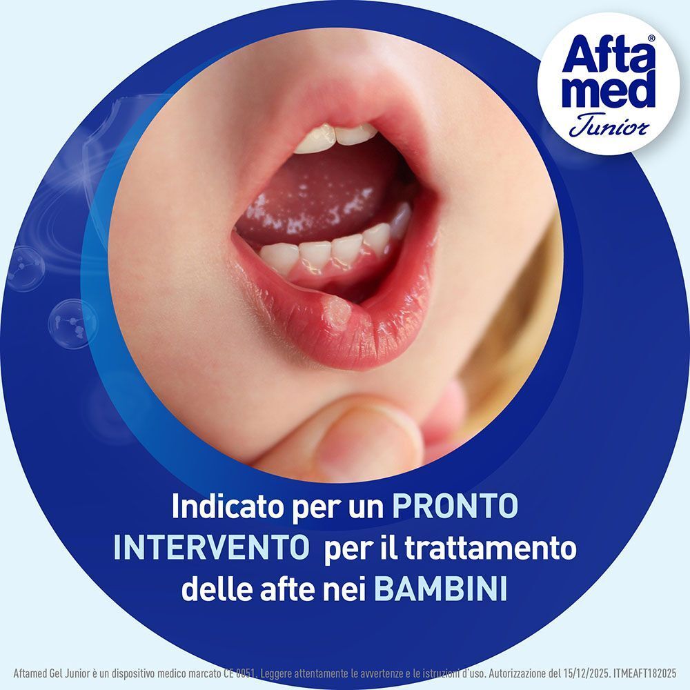 AftaMed Junior: indicato per pronto intervento per afte nei bambini.