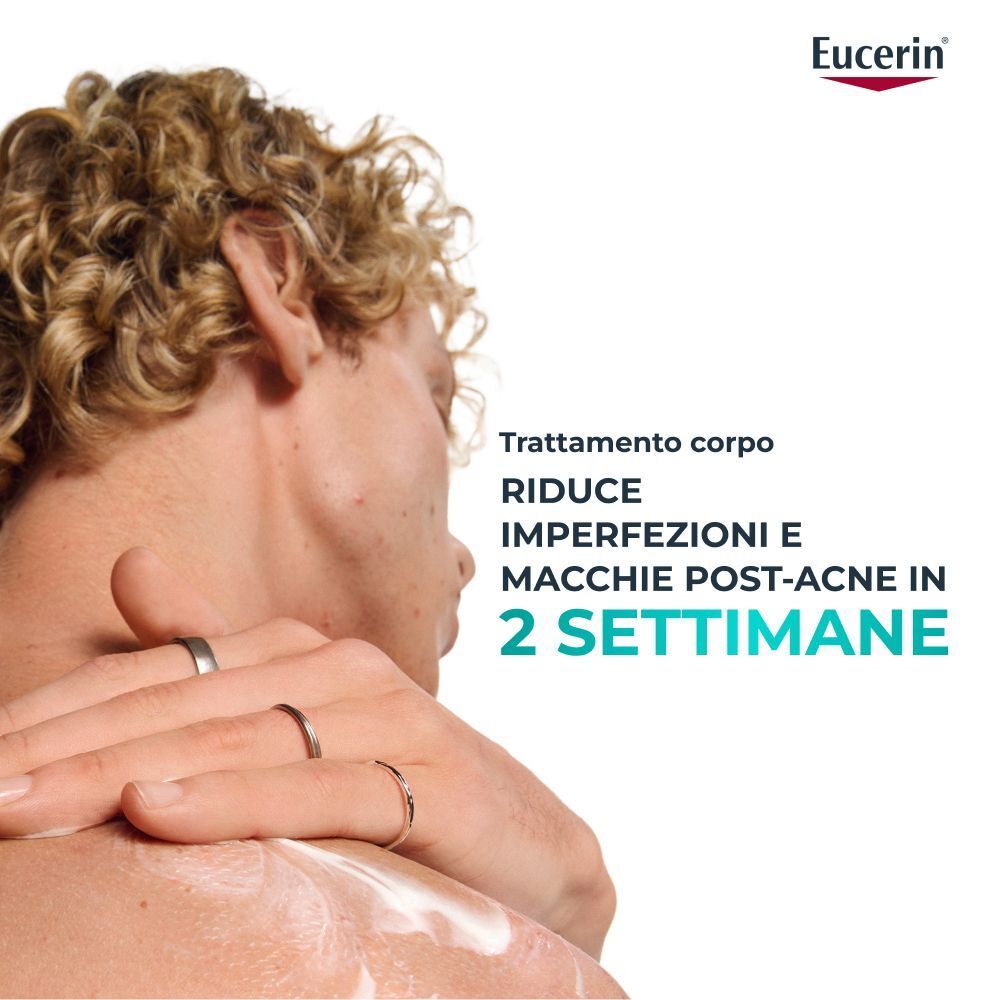 Eucerin Dermopure Crema Corpo riduce imperfezioni e macchie post-acne in 2 settimane.
