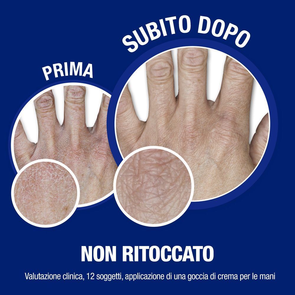 Confronto prima e dopo di mani secche trattate con crema mani e unghie Neutrogena.