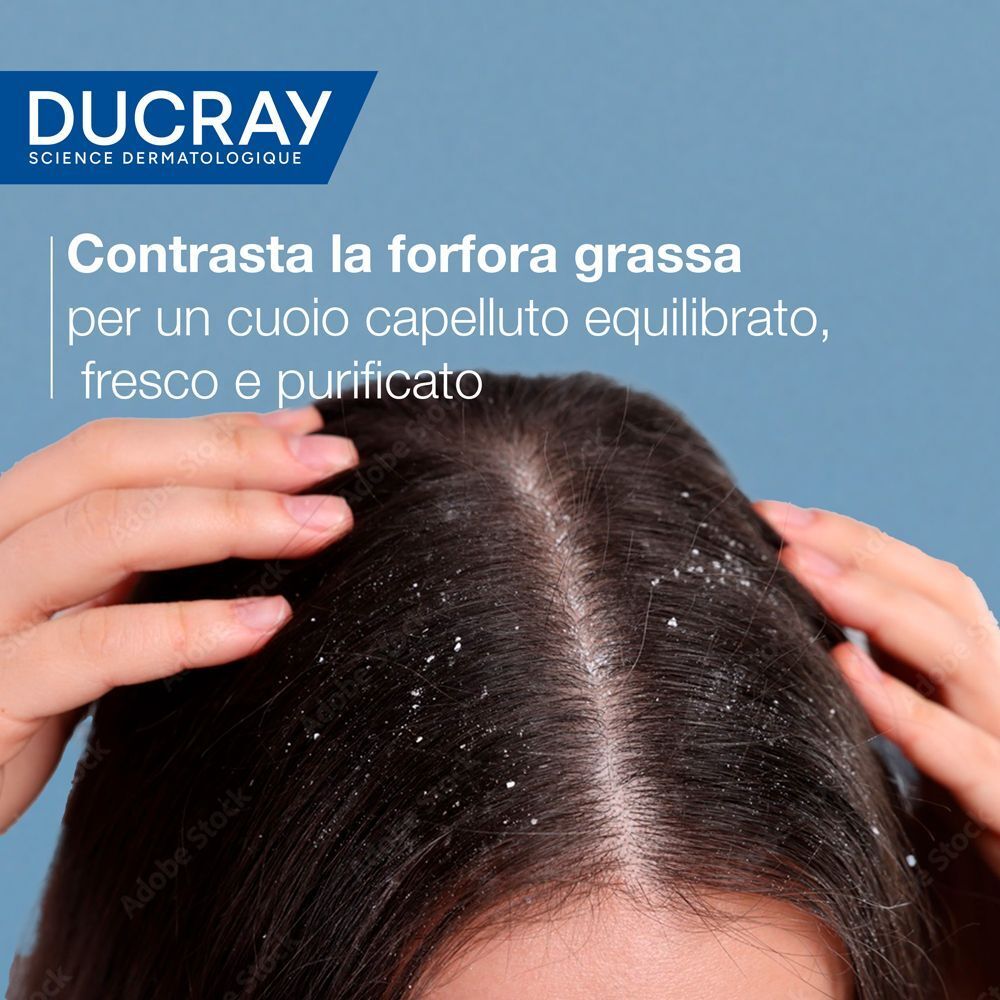 Ducray Kelual Squanorm Shampoo Antiforfora Trattante Regolatore Forfora Grassa 400ml, Elimina 100% della forfora Azione anti-ricomparsa, Cuoio capelluto grasso