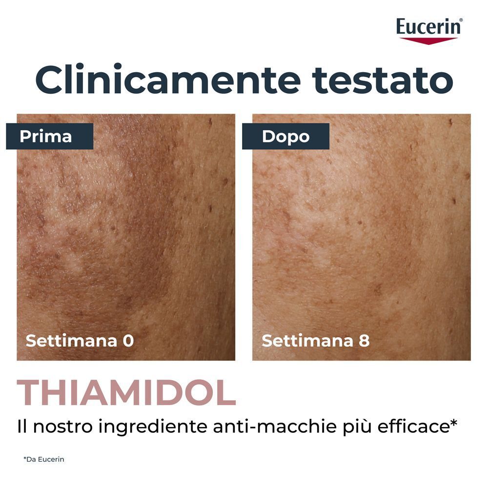 Confronto prima e dopo della pigmentazione cutanea che mostra l'efficacia del Thiamidol.