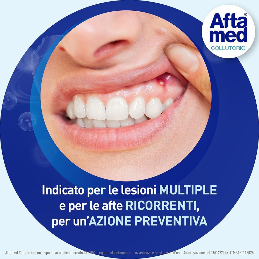 Aftamed Colluttorio: per lesioni multiple e afte ricorrenti.