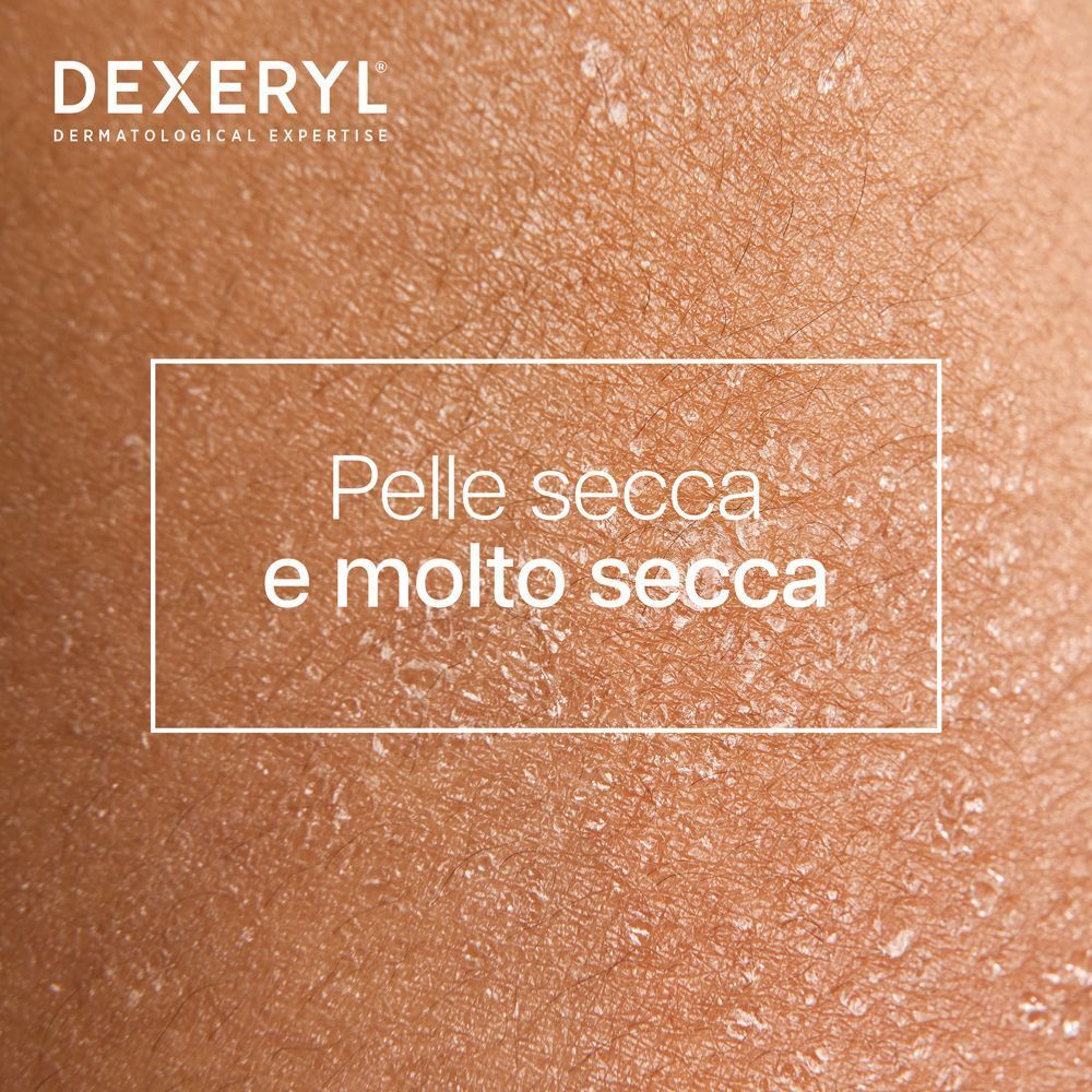 Primo piano di pelle secca e desquamata.