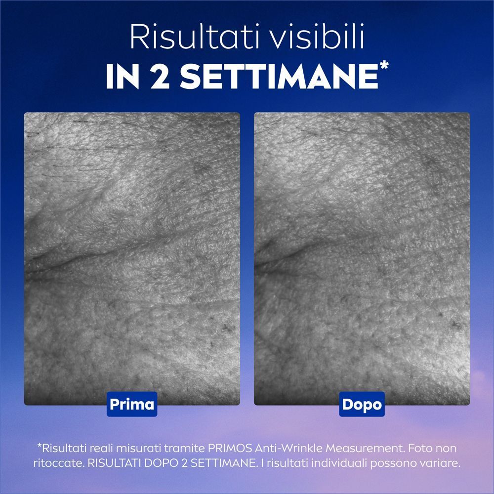 Confronto prima e dopo della texture della pelle che mostra l'effetto di un siero antirughe.