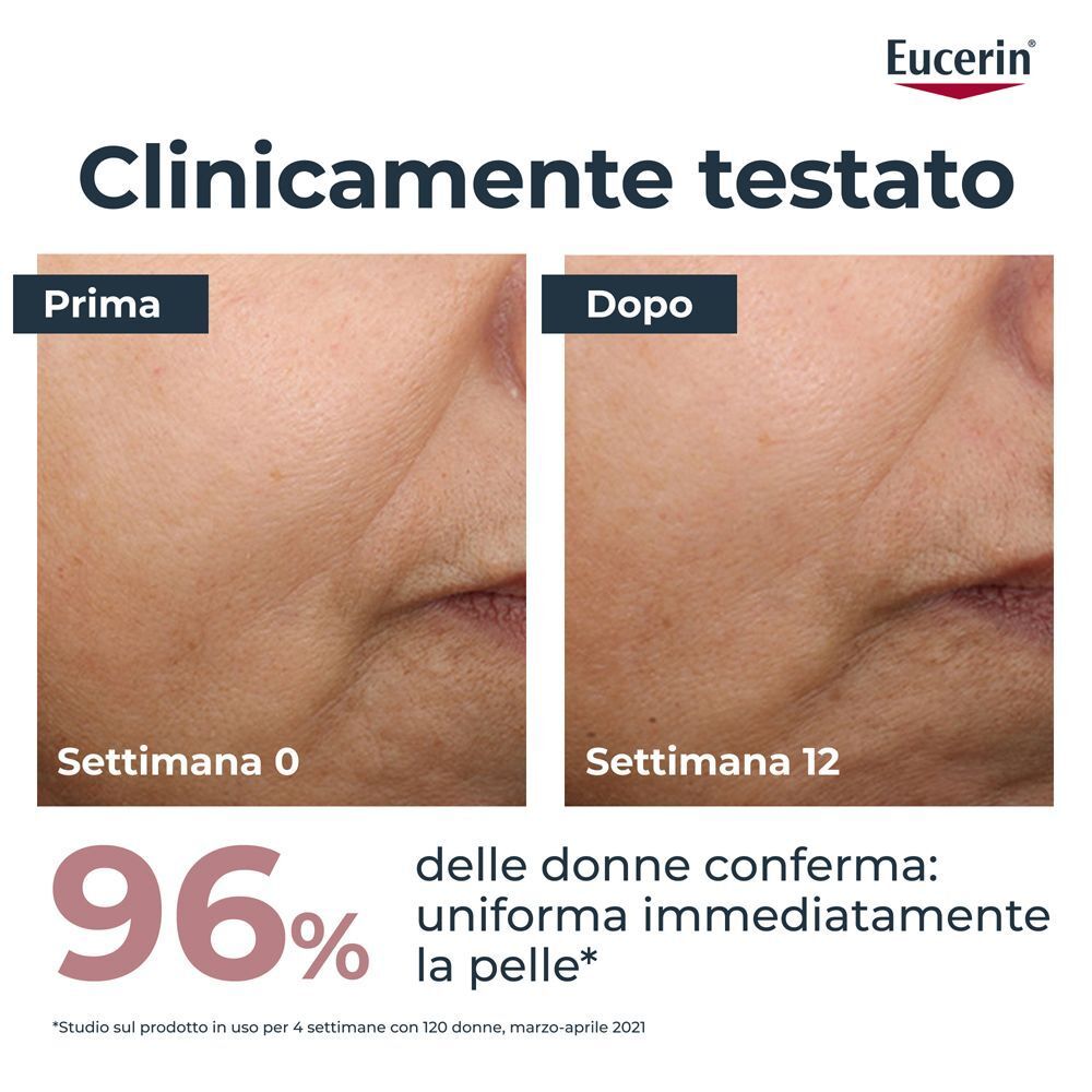 Confronto prima e dopo della pelle con Eucerin Anti-Pigment Crema Giorno SPF 30 Colorata Light.