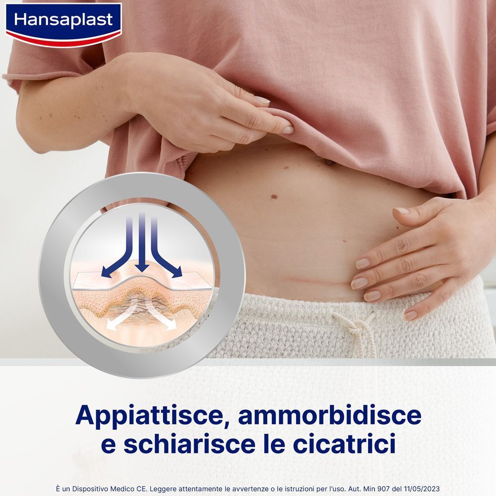 Primo piano di una cicatrice addominale, con rappresentazione schematica dell'effetto del cerotto.