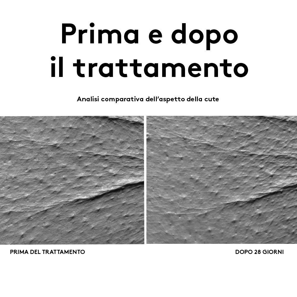 Confronto texture cutanee prima e dopo 28 giorni di trattamento.