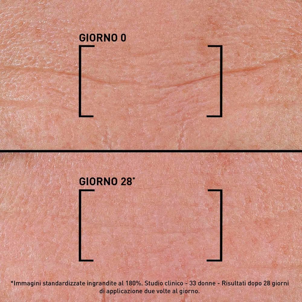 Confronto delle rughe della pelle prima e dopo 28 giorni di applicazione del Filorga Time-Filler Intensive 5XP.