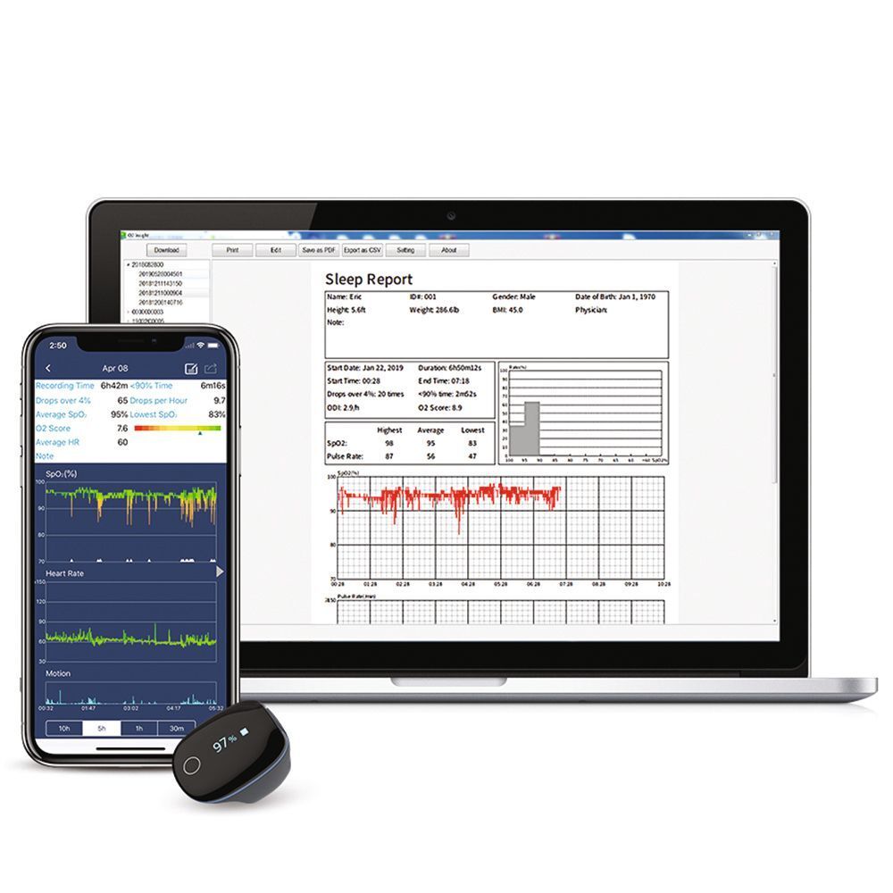 Pulsossimetro GIMA O2Ring accanto a smartphone e laptop con dati del rapporto sul sonno.