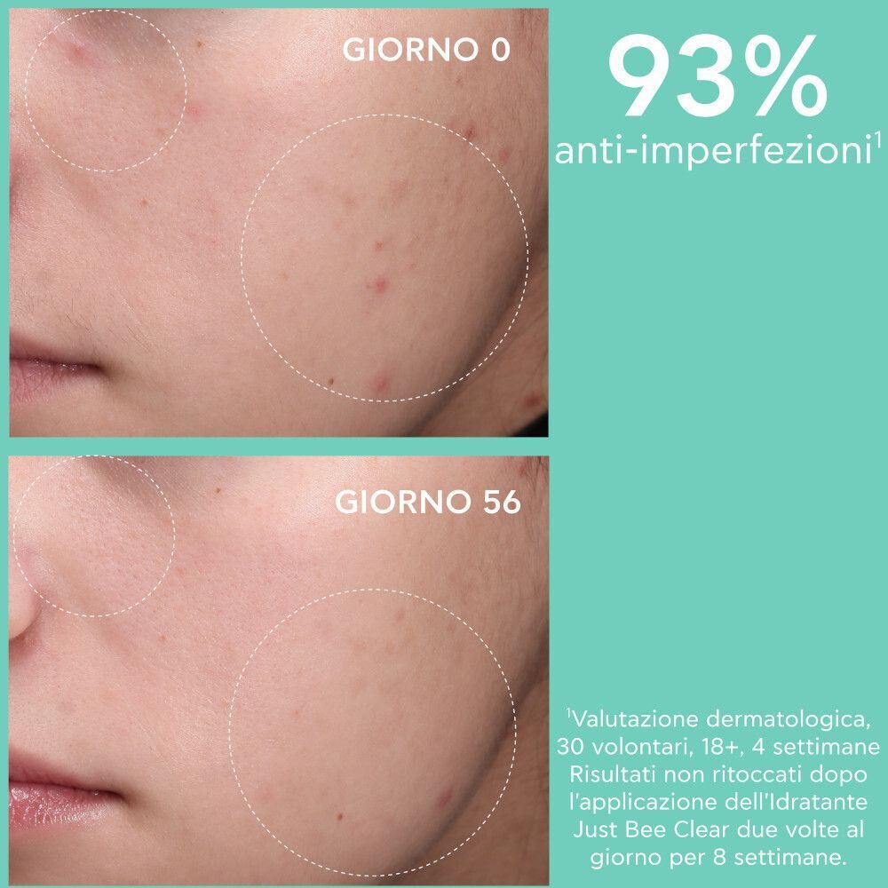 Confronto prima e dopo della pelle con crema viso idratante opacizzante Apivita Just Bee Clear.