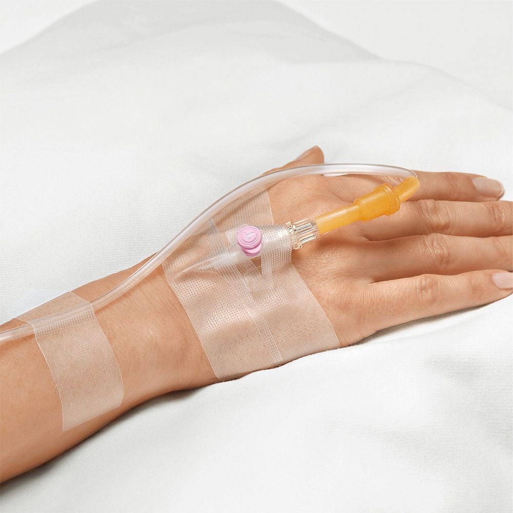 Un catetere venoso con linea di infusione, fissato sul dorso della mano di una persona.
