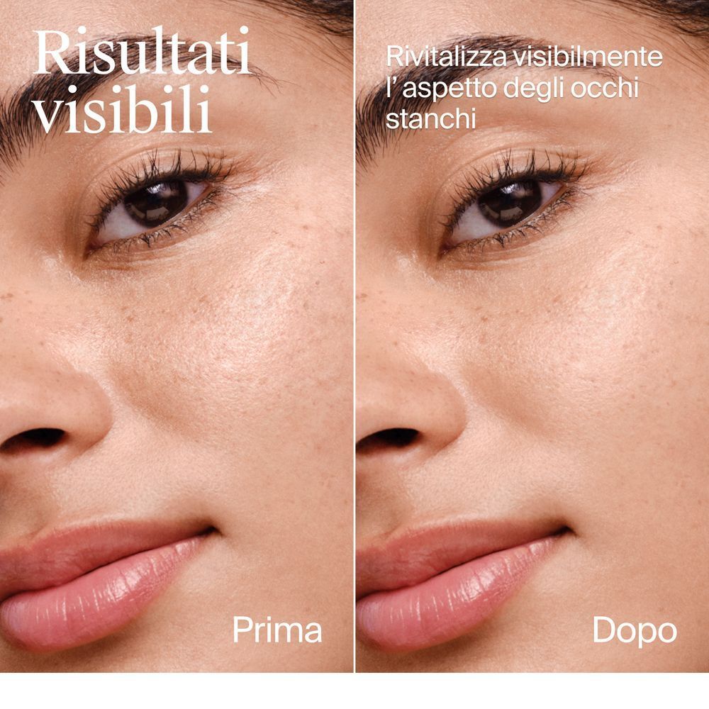 Confronto prima e dopo della pelle del contorno occhi, che mostra le linee sottili.