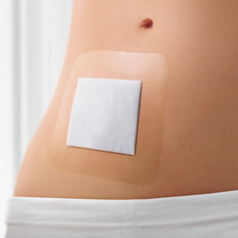 Person mit Wundauflage auf dem Bauch. Die transparente Auflage bedeckt die Haut. Ein weißes Pad ist sichtbar.