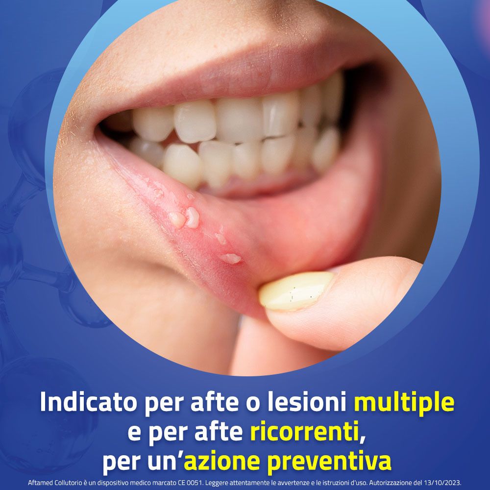 Bocca con afte. Testo: Indicato per afte o lesioni multiple e per afte ricorrenti, per un'azione preventiva.