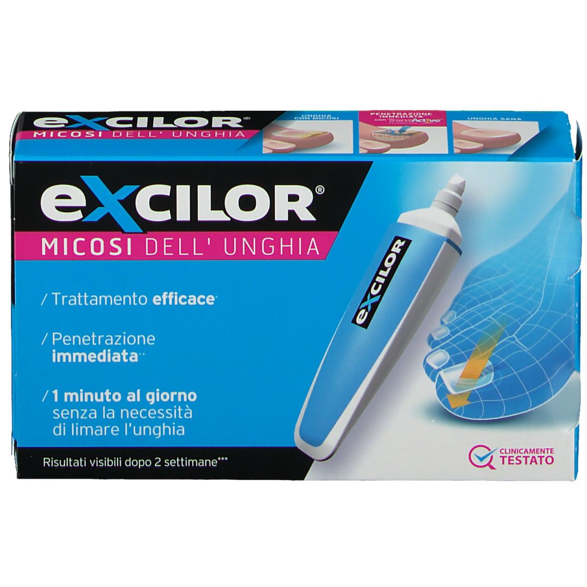 Confezione del prodotto con immagine e piede. Testo: Excilor, Micosis dell'unghia, clinicamente testato.