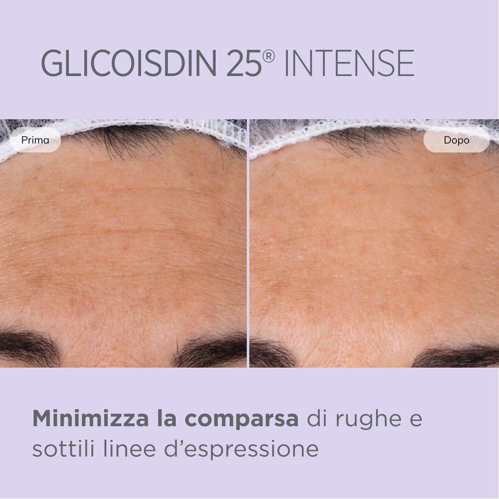 Immagine prima e dopo. Pelle prima e dopo l'uso di ISDIN Glicoisdin 25 Intense. Testo su sfondo viola.