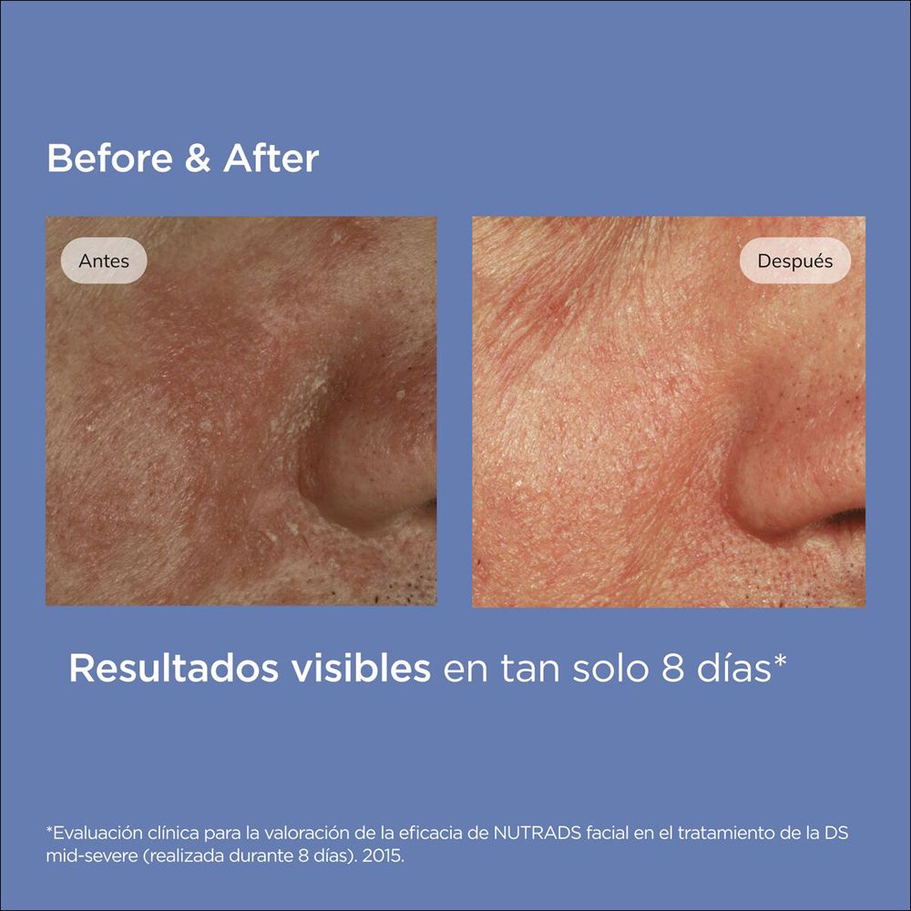 Vorher/Nachher-Bilder von Haut mit ISDIN Nutradeica Gel Crema Viso.