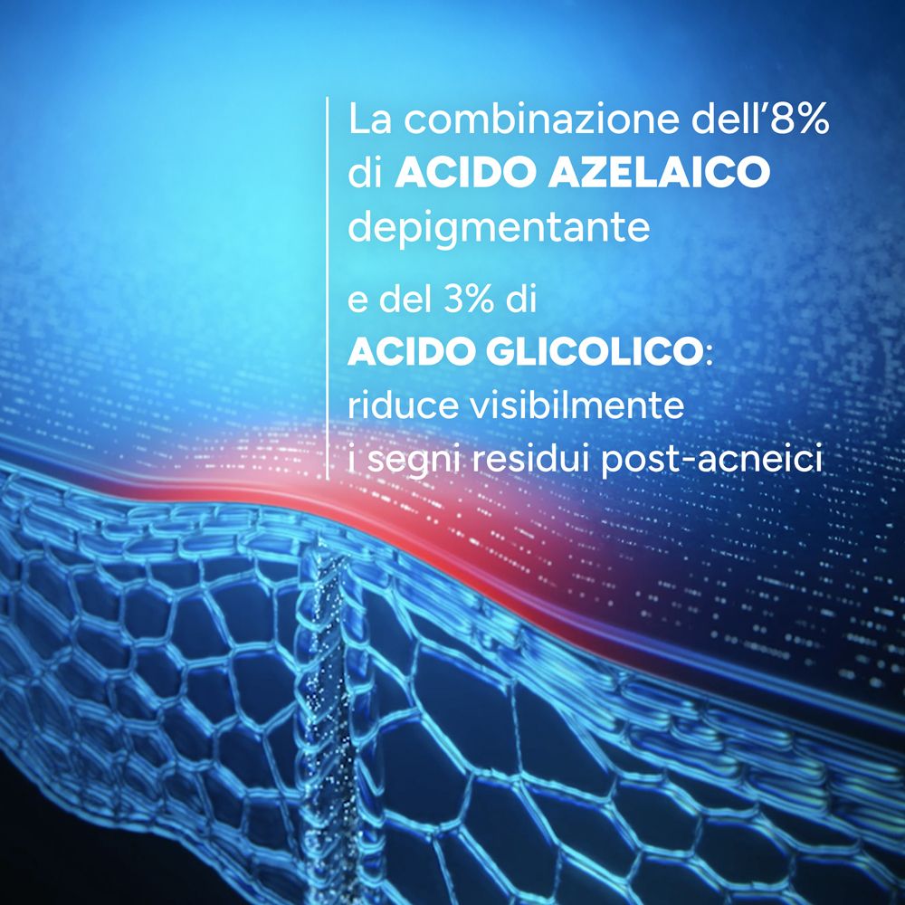 Rappresentazione molecolare: 8% acido azelaico e 3% acido glicolico riducono i segni post-acneici.