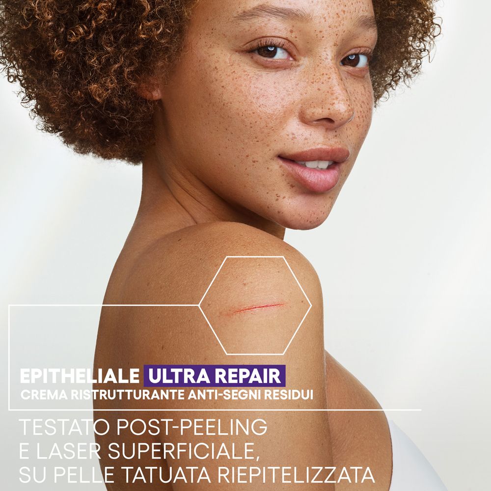 Frau mit Hautunreinheiten. Text: Epitheliale Ultra Repair, Crème Ristrutturante Anti-Segni Residui. Getestet nach Post-Peeling.