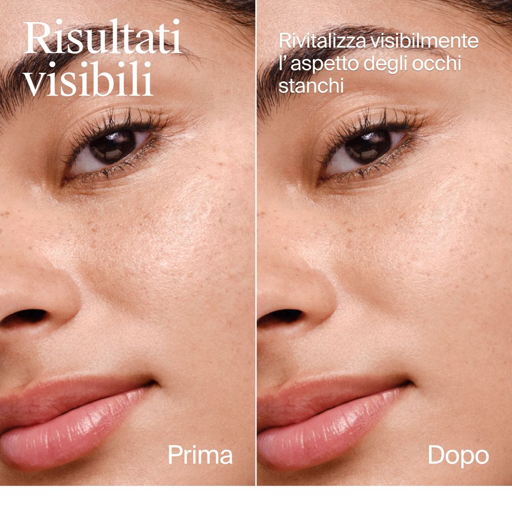 Confronto prima e dopo della pelle del contorno occhi.