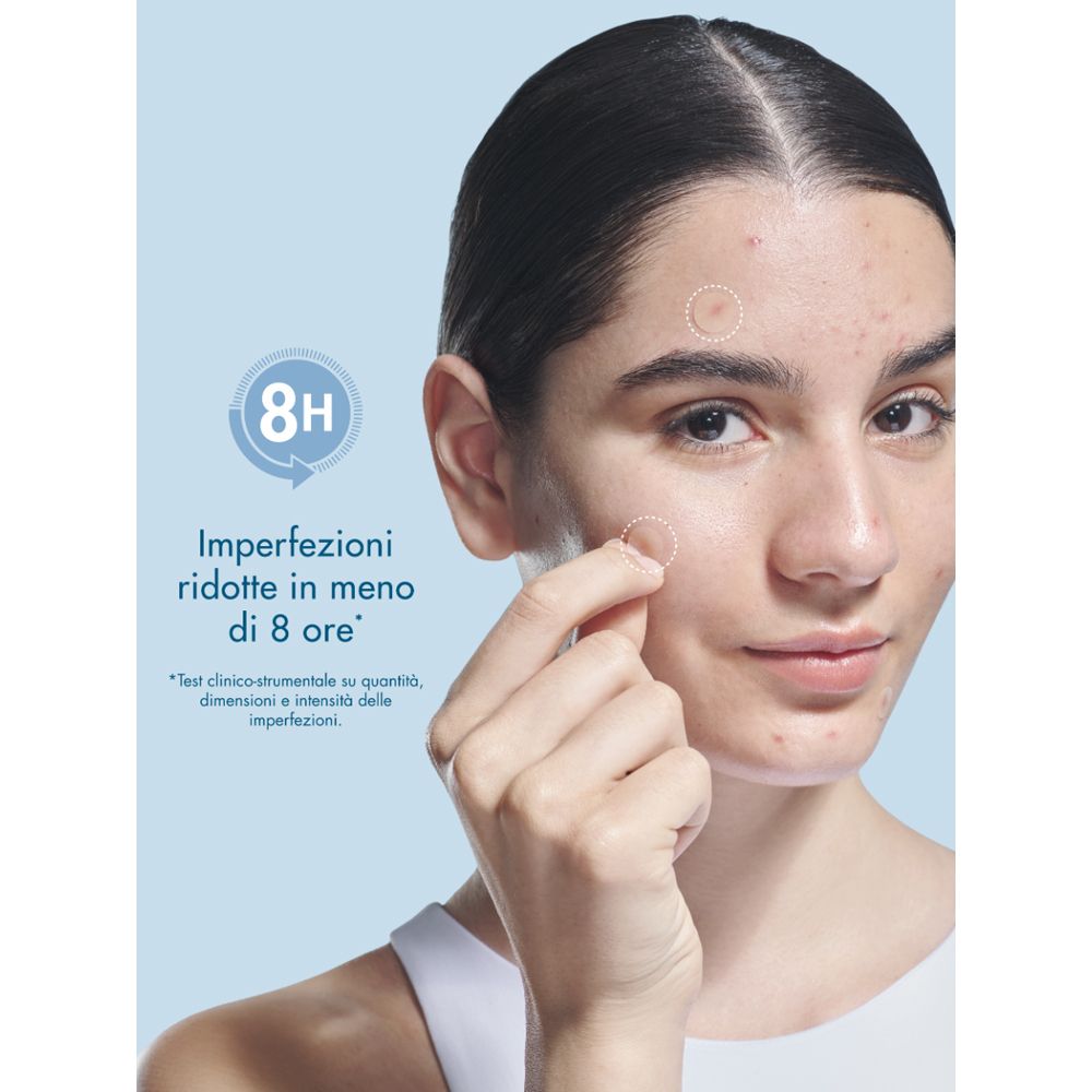 Donna con imperfezioni cutanee applica un patch Miamo Invisible sulla guancia.