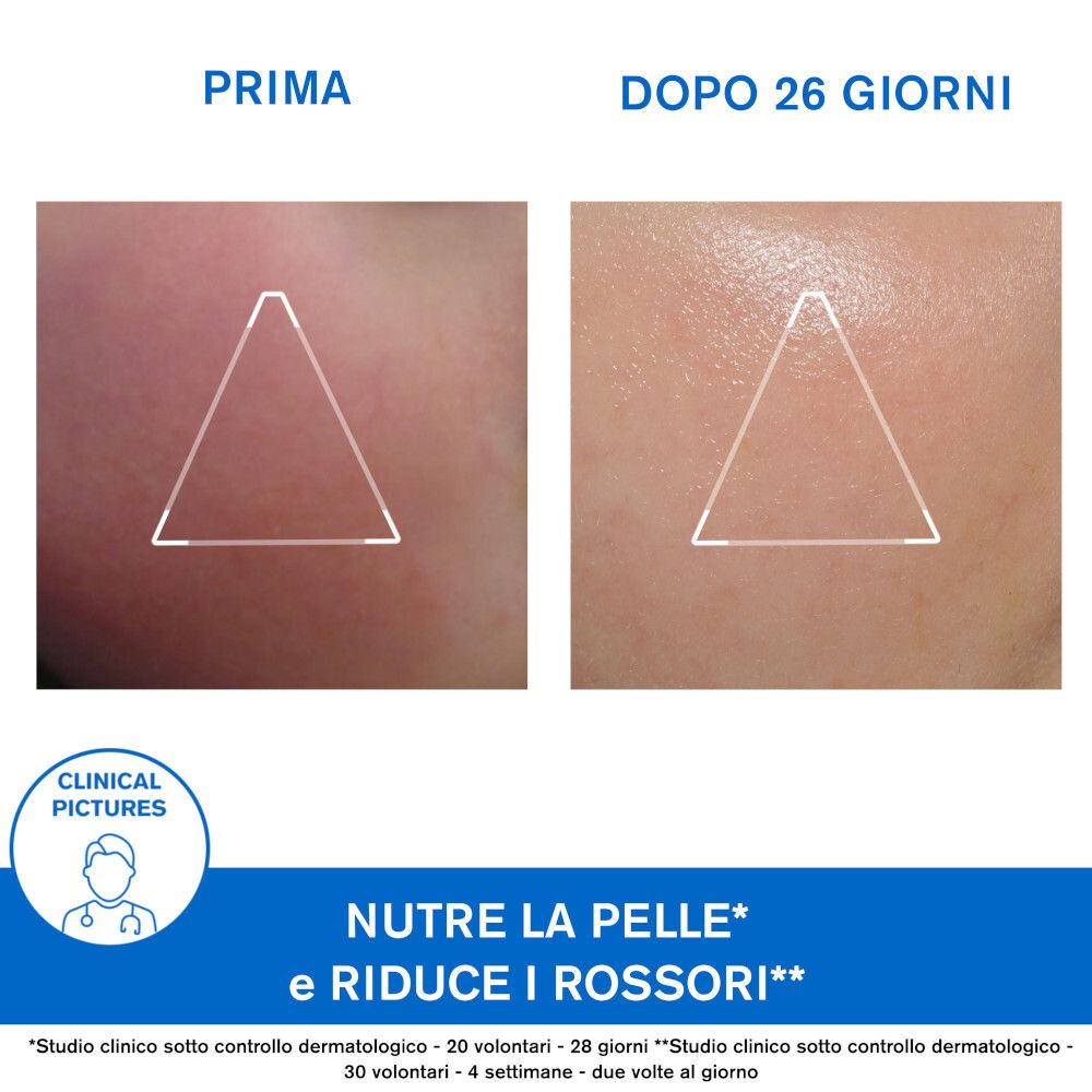 Immagini comparative: Prima/Dopo. Testo: Nutre la pelle e riduce i rossori.