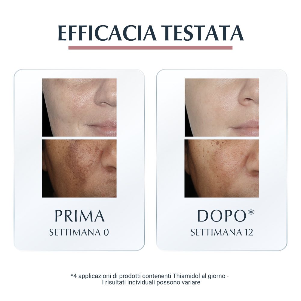 Immagini prima-dopo di volti. Testo: Prima (Settimana 0), Dopo (Settimana 12).