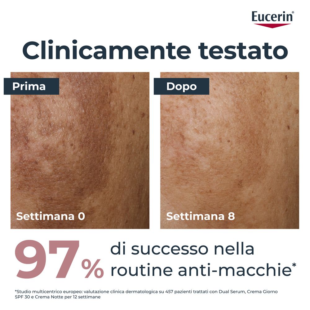 Confronto pelle: Prima/Dopo. Testo: Clinicamente testato. 97% di successo nella routine anti-macchie.