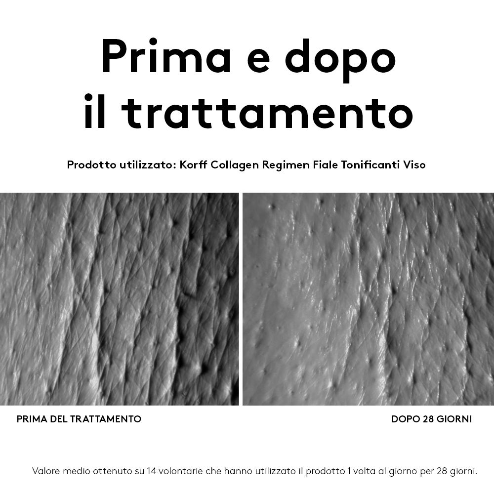 Vorher-Nachher-Vergleich von Haut. Text: Prima e dopo il trattamento. Produkt: KORFF Collagen Regimen Fiale Tonificanti Viso.