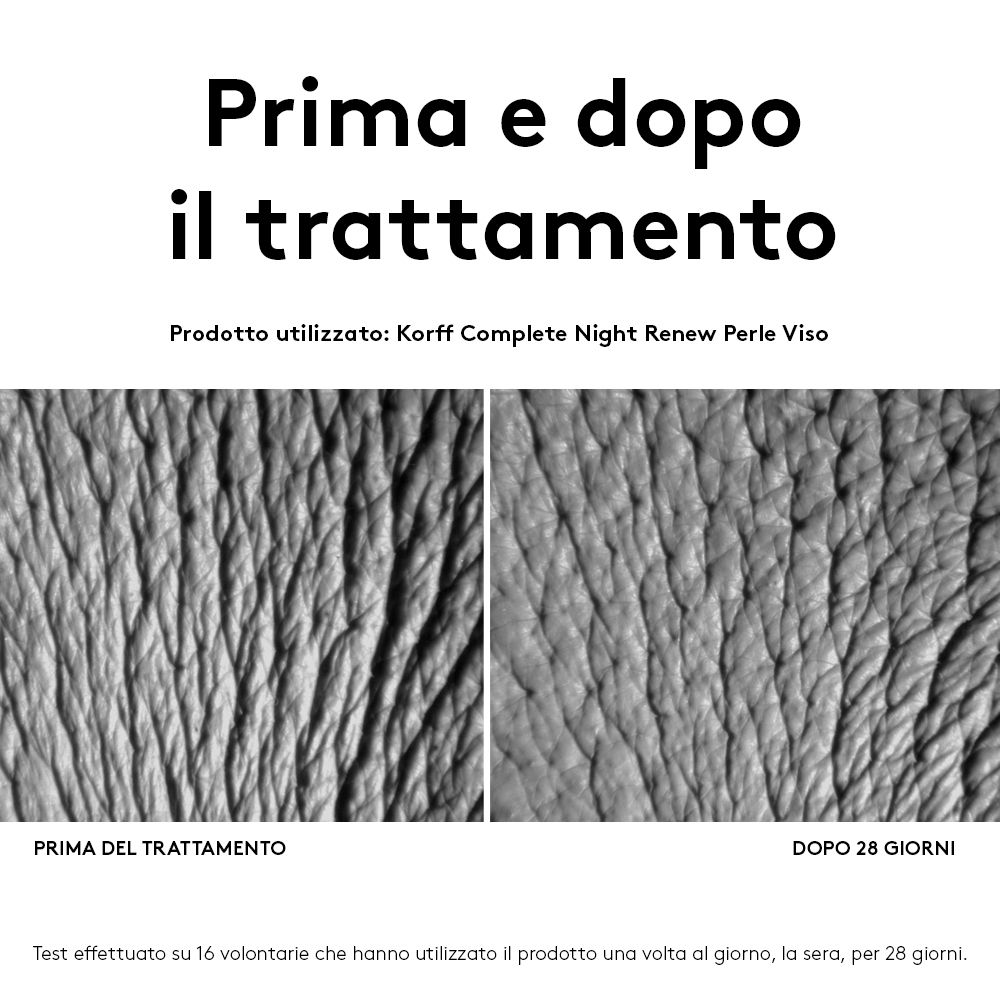 Vergleich von Haut vor und nach der Behandlung. Text: Prima e dopo il trattamento. Produkt: KORFF Complete Night Renew Perle Viso.