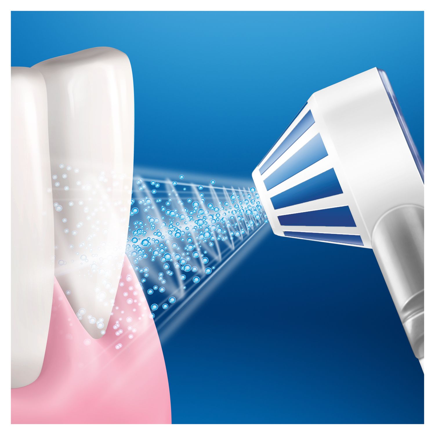 Primo piano di denti e ugello dell'irrigatore orale. Getto d'acqua tra denti e gengive.