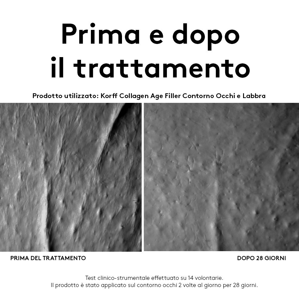 Vorher-Nachher-Vergleich von Haut. Text: „KORFF Collagen Age Filler Contorno Occhi e Labbra“.