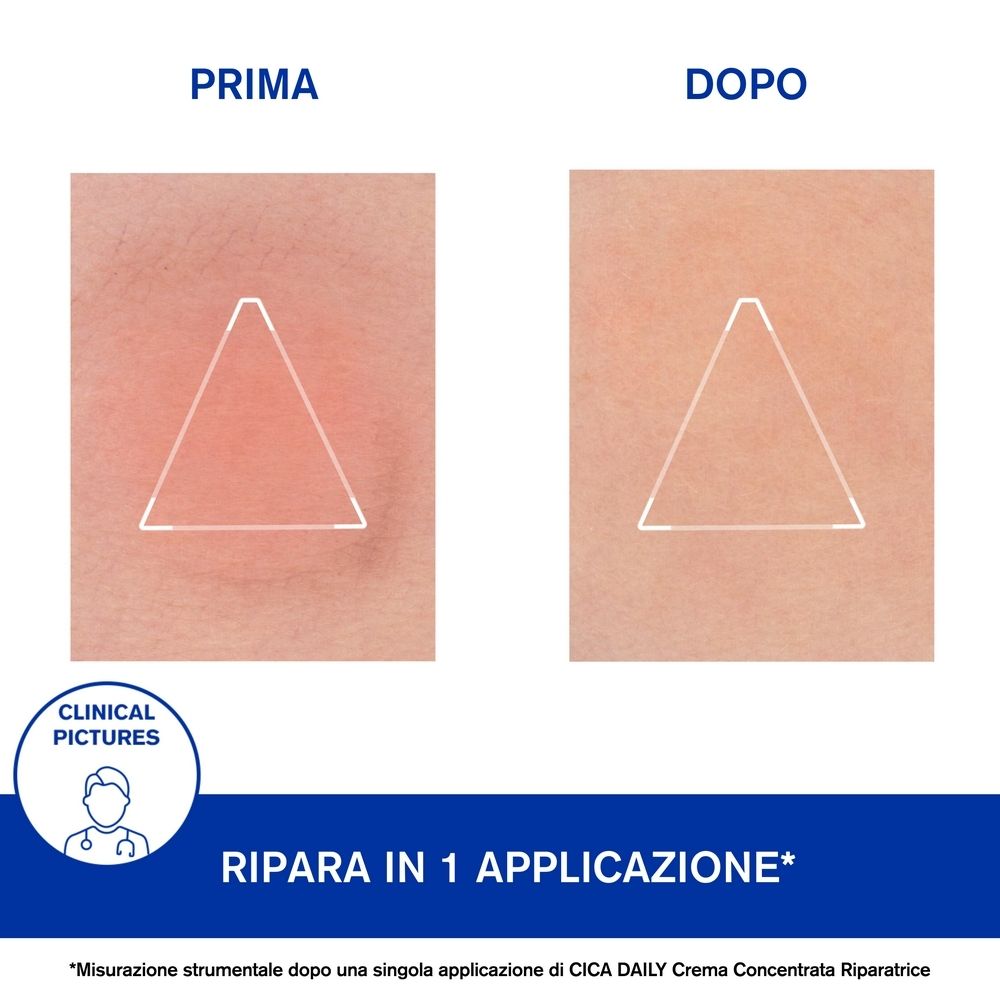 Immagine prima-dopo della pelle. Testo: PRIMA, DOPO, Ripara in 1 applicazione.