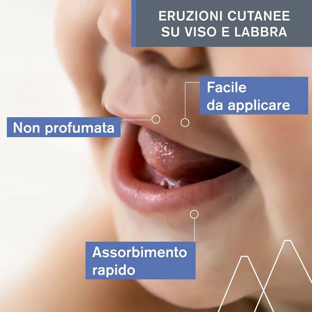 Primo piano di un bambino. Scritte: Non profumato, facile da applicare, assorbimento rapido. Eruzioni cutanee su viso e labbra.