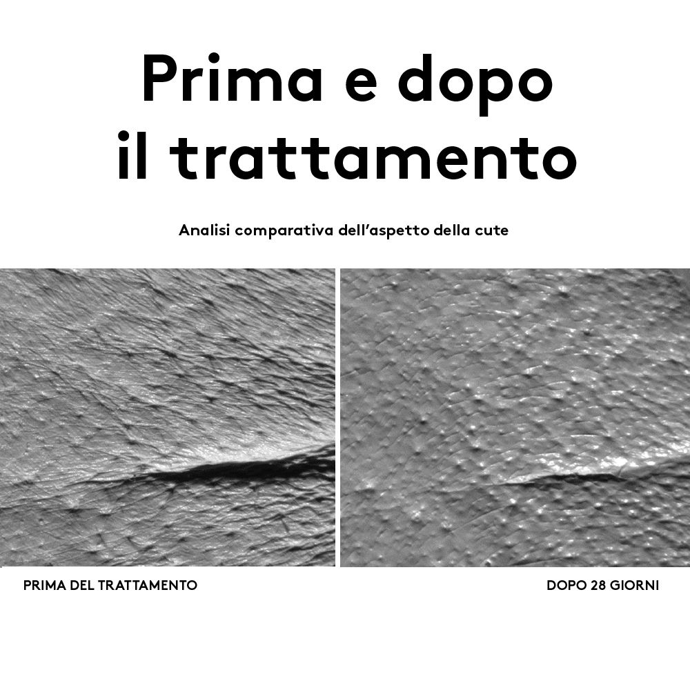 Due primi piani della pelle. Sinistra: Prima del trattamento. Destra: Dopo 28 giorni.