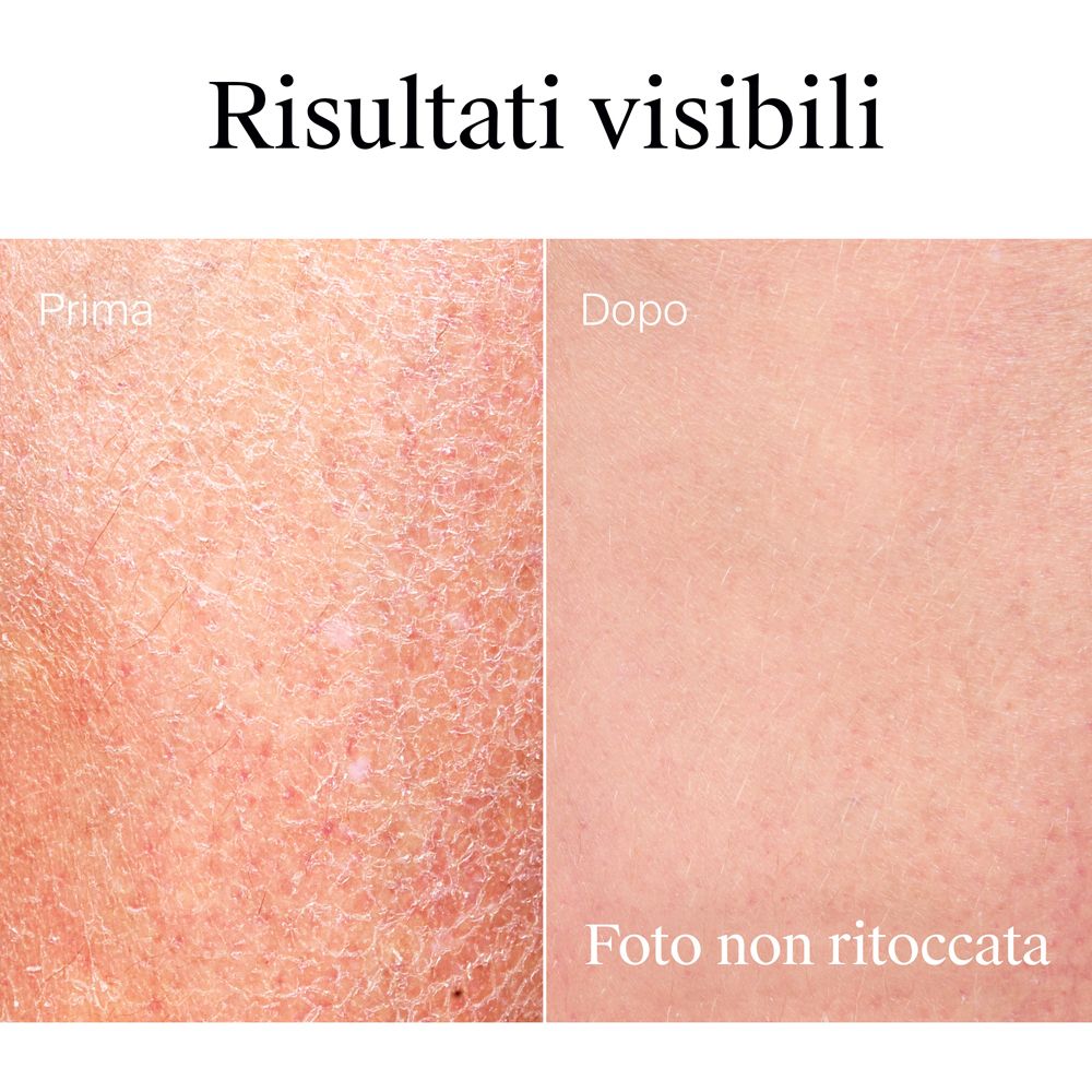 Neutrogena Körpercreme zieht schnell ein und ermöglicht sofortiges Anziehen.