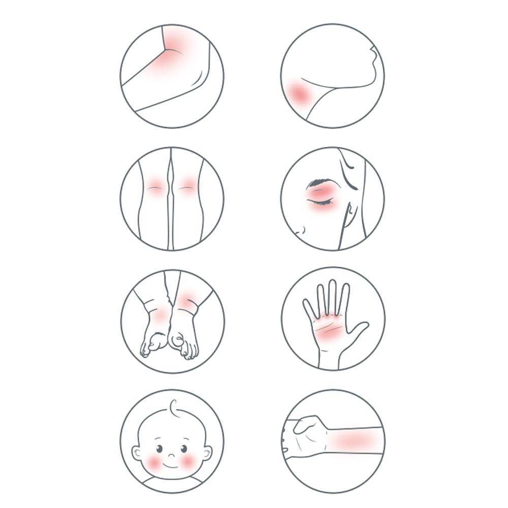 Illustrazioni circolari di parti del corpo con aree rosse, come articolazioni e pelle.
