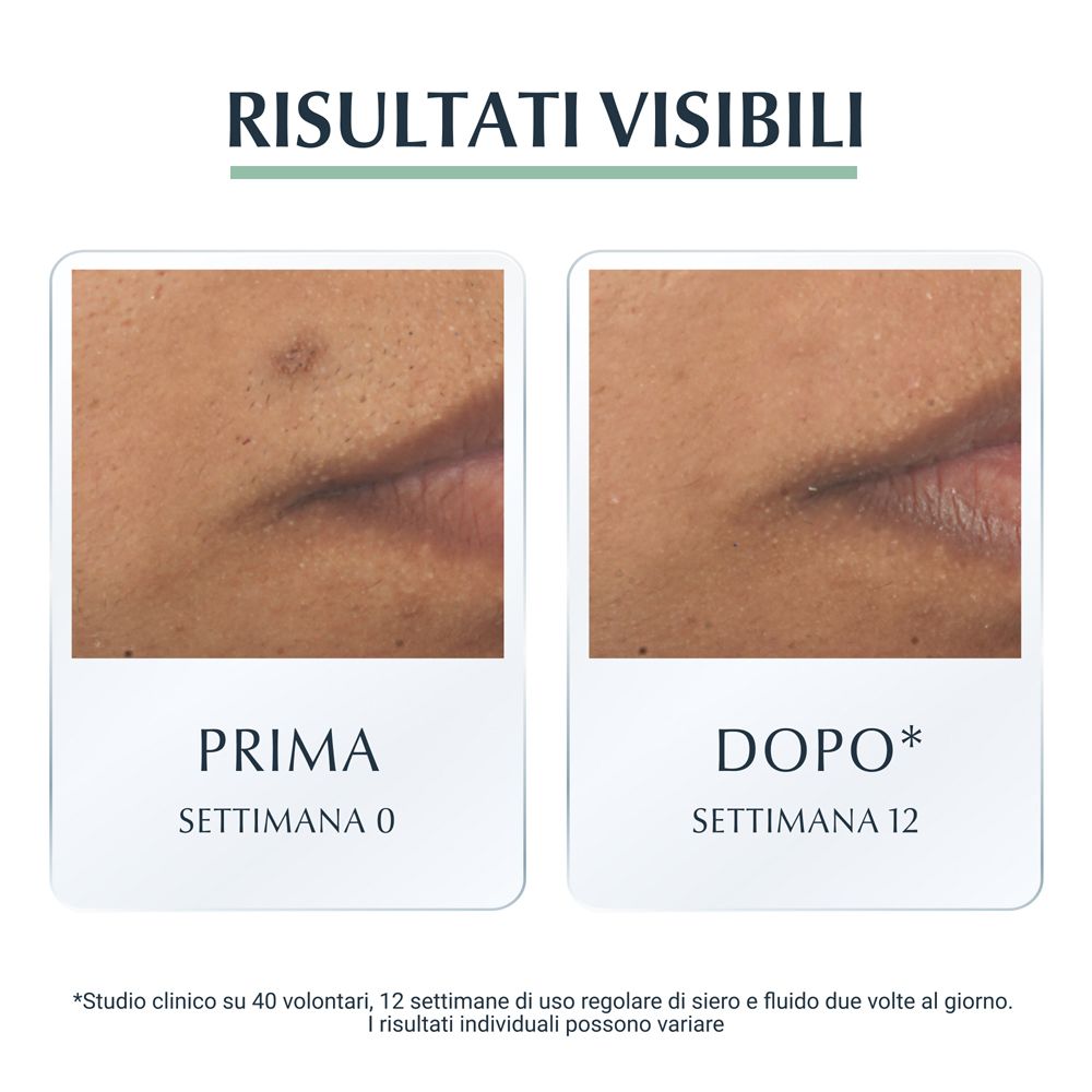 Immagini prima-dopo. Testo: Prima, Settimana 0. Dopo, Settimana 12. I risultati possono variare.