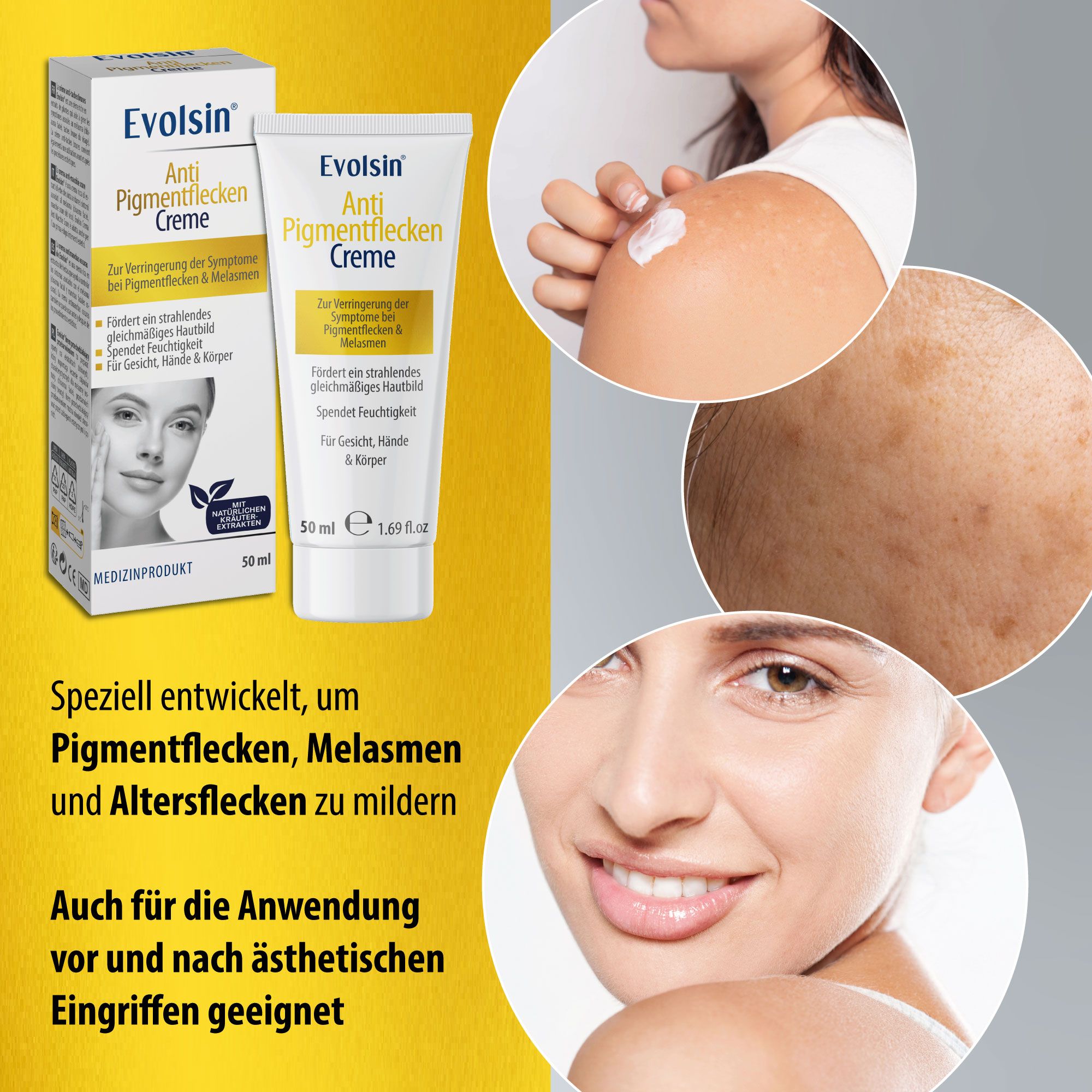 Produktverpackung und Creme-Tube. Text: EVOLSIN® Crème anti-taches. Für Pigmentflecken, Melasmen und Altersflecken.