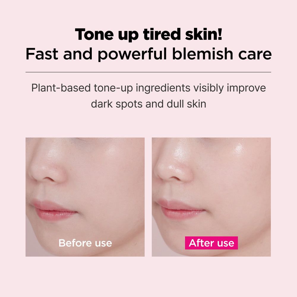 ISOI Blemish Care Mask