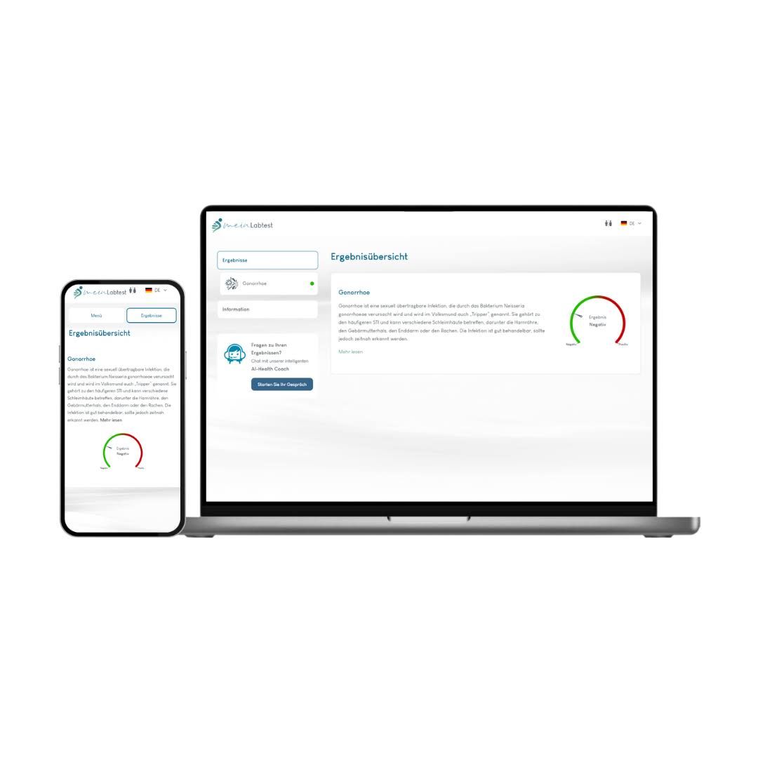 Meinlabtest Tripper-Test Männer (Urin)