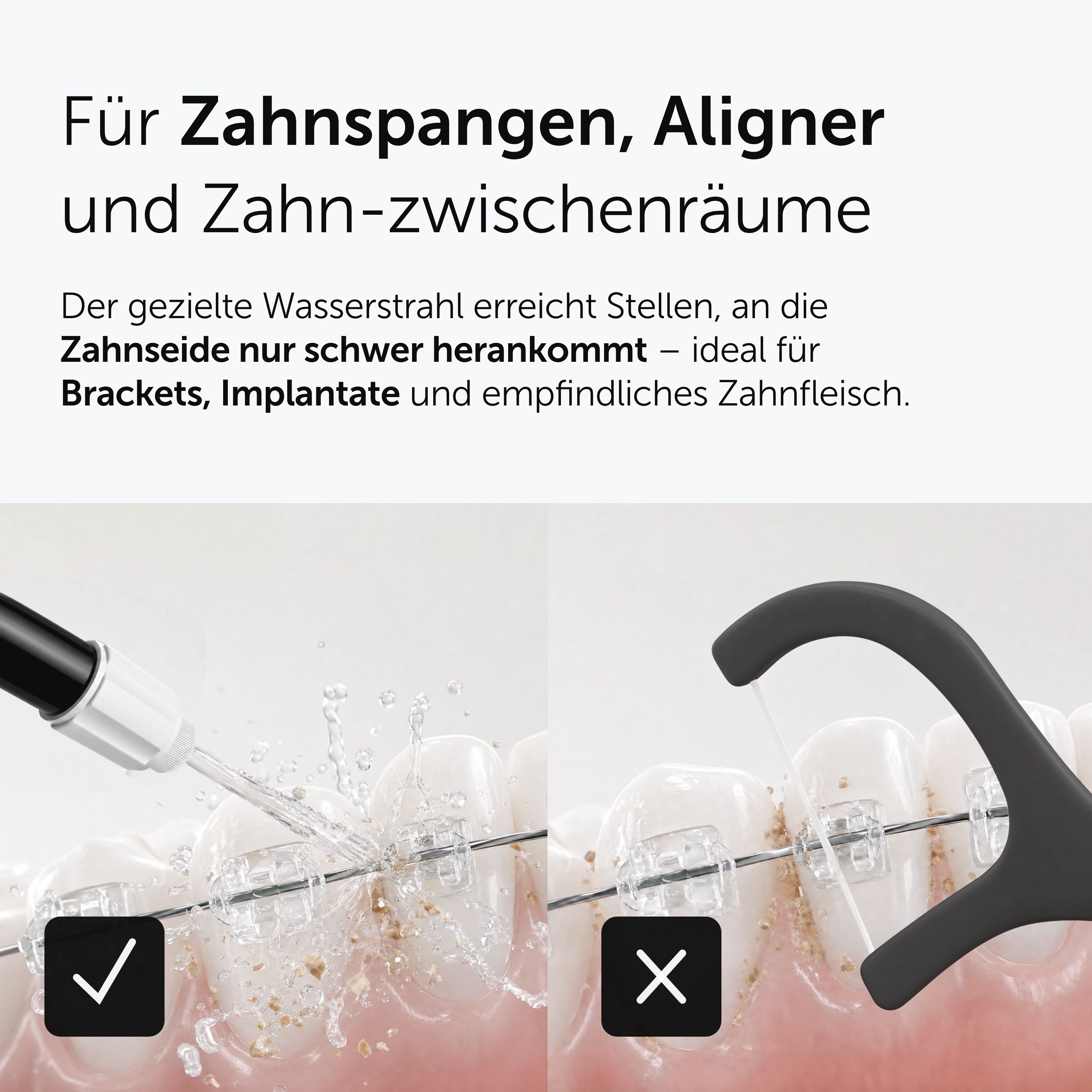 Munddusche reinigt Zahnspangen und Zahnzwischenräume effektiv.