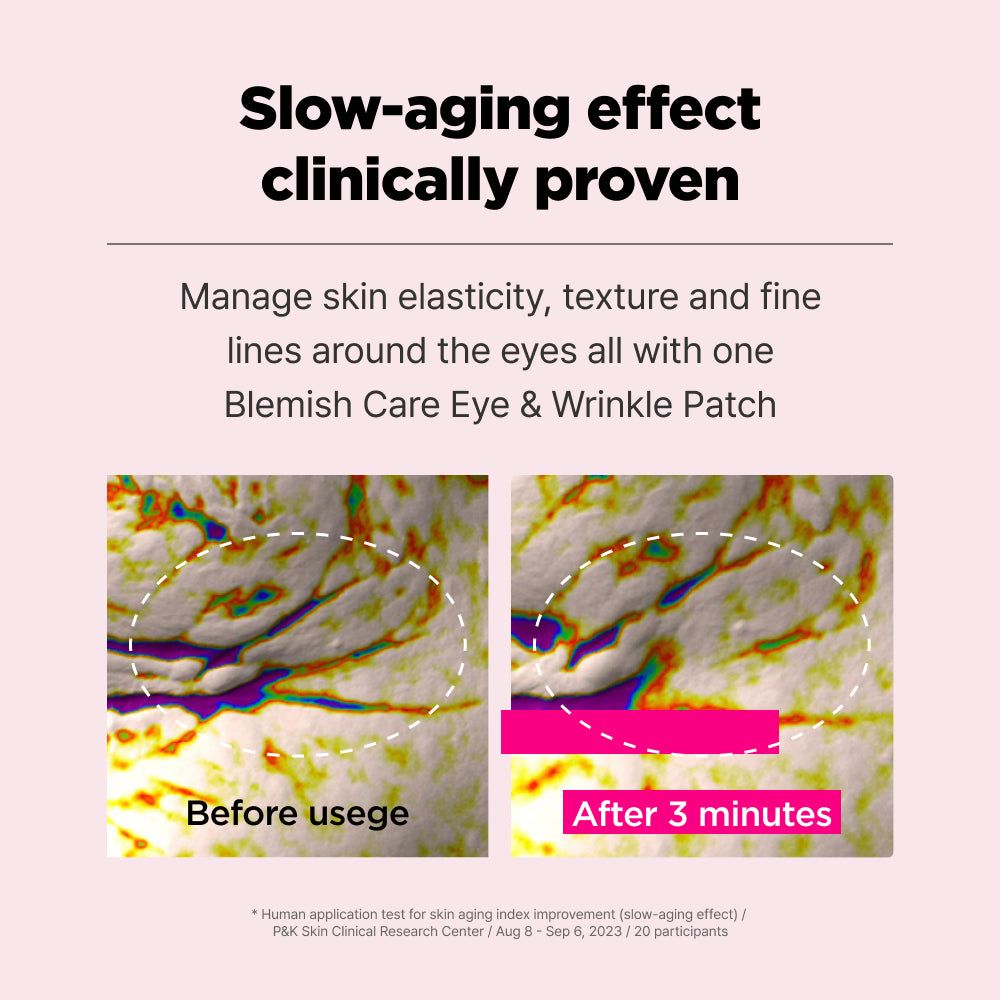 ISOI - Blemish Care Augen- und Faltenpflaster