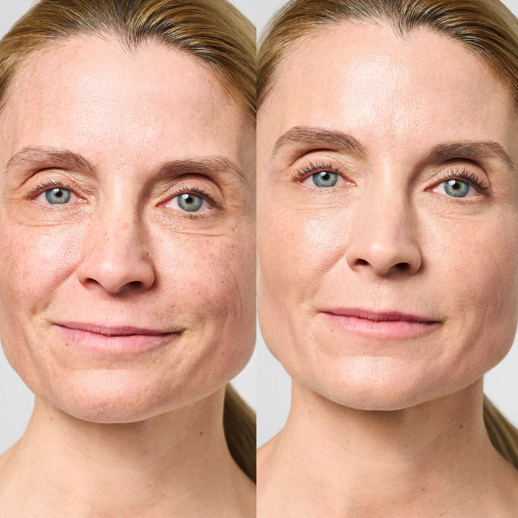 Mimic Booster Anti-Mimikfalten-Serum