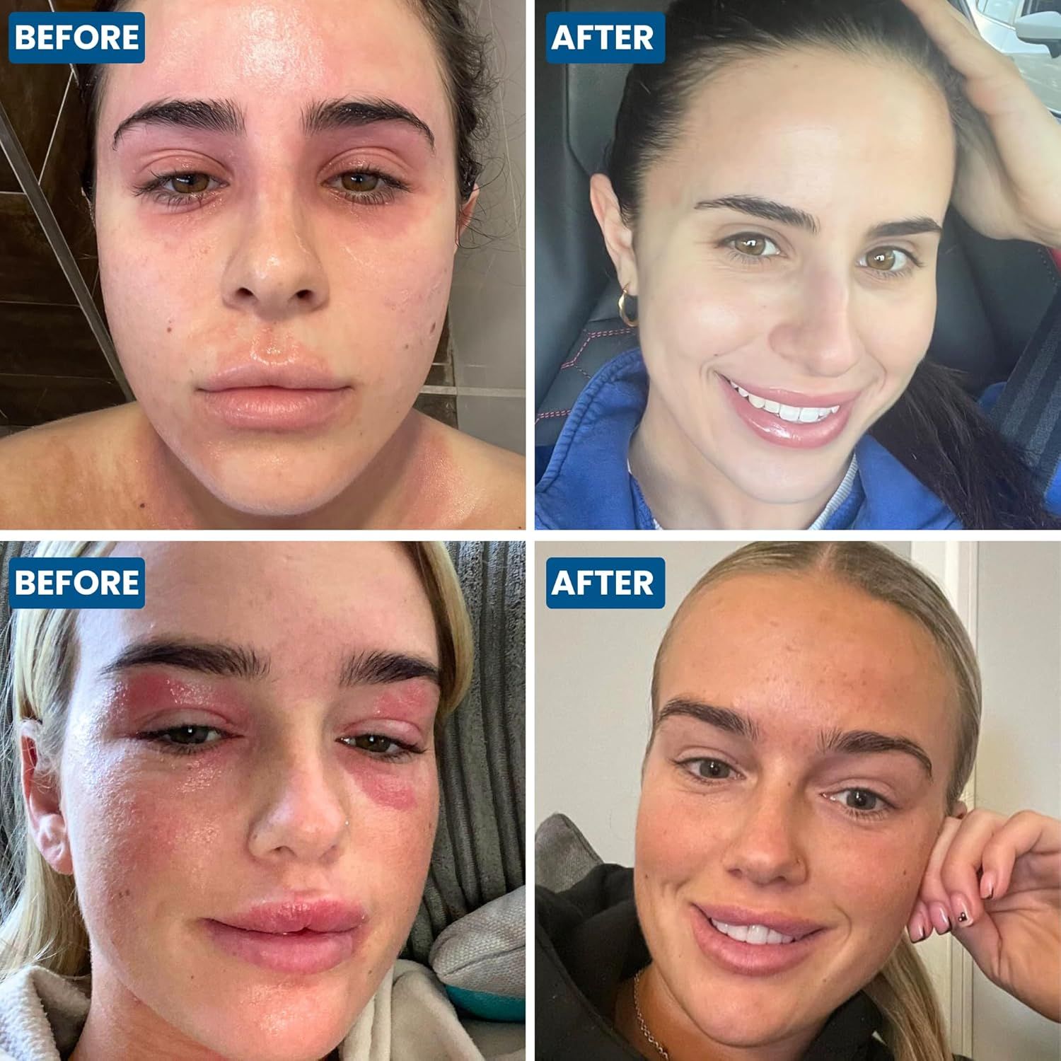 Grahams Natural®  Gesicht & Augenlid Ekzem Creme