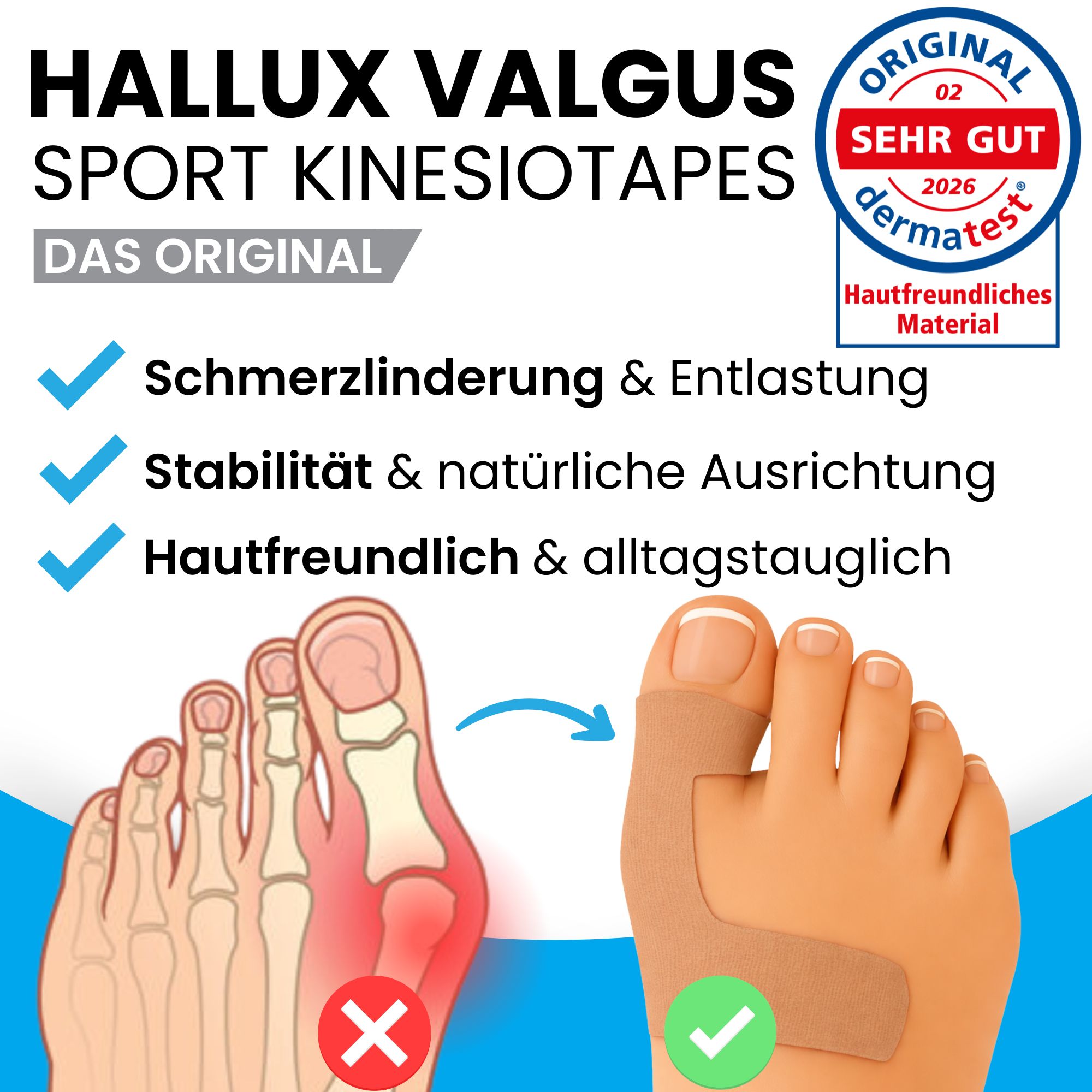 Hallux Valgus Kinesio-Tapes: Schmerzlinderung, Stabilisierung, hautfreundlich. Zeigt eine schematische Darstellung des Fußes und ein angelegtes Tape.