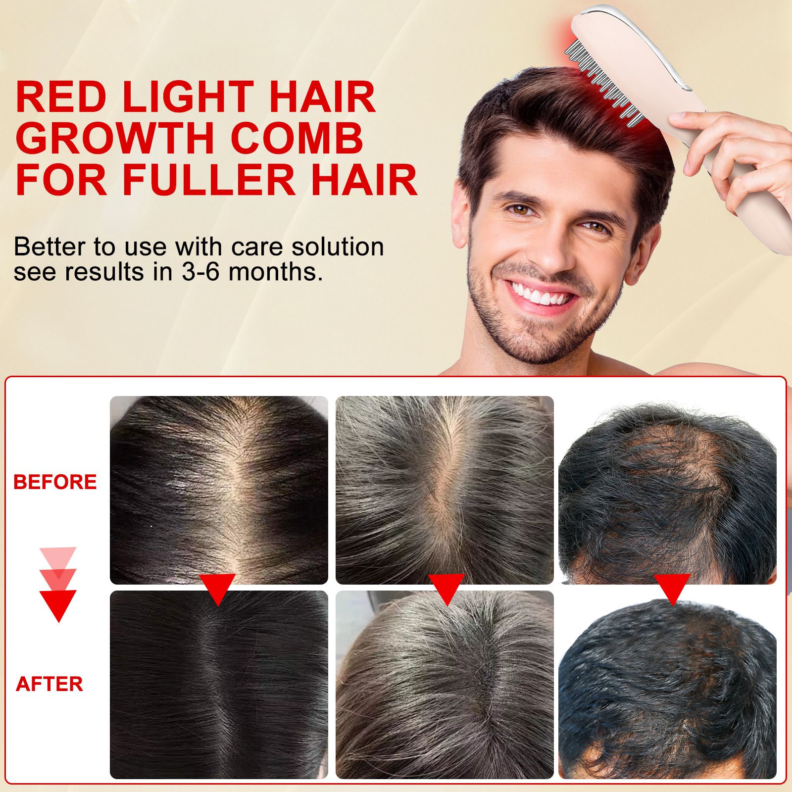 COOL-i 5 in 1 Kopfhaut Massagebürste,LED, Infrarot, EMS, Ionen & Nebel für Kopfhautpflege